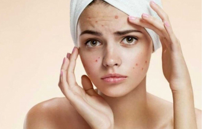 manfaat lidah buaya