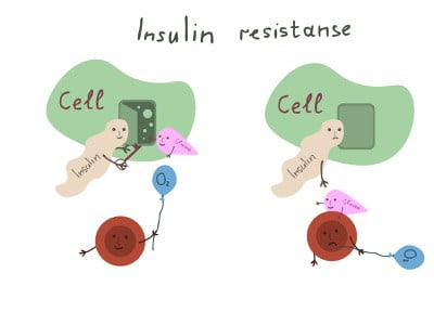 Hormon Insulin: Penjelasan, Proses Terbentuk dan Fungsinya
